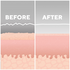 Homedics Radiance Microdermabrasion-Exfoliator and Cooling Device MD-1000-AU image NaN