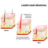 Xemos Silhouette Laser Hair Remover 351025 image NaN